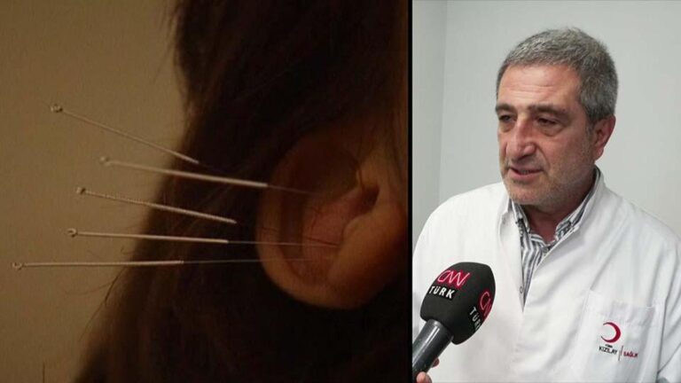 Akupunktur tedavisi nasıl uygulanır?