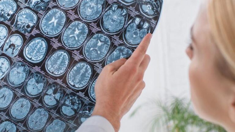 Beyin Sağlığı Uzmanından Yararlı Beslenme Önerileri