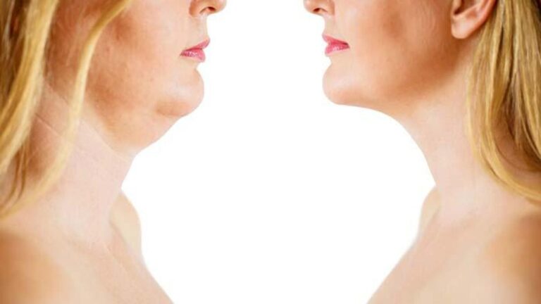 Cildin gevşemesini önlemek için bu alışkanlıkları mı almalıyız?