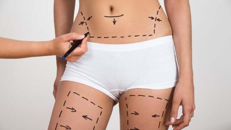 Vücudunuz yaz için hazır mı? – Sağlık Haberleri