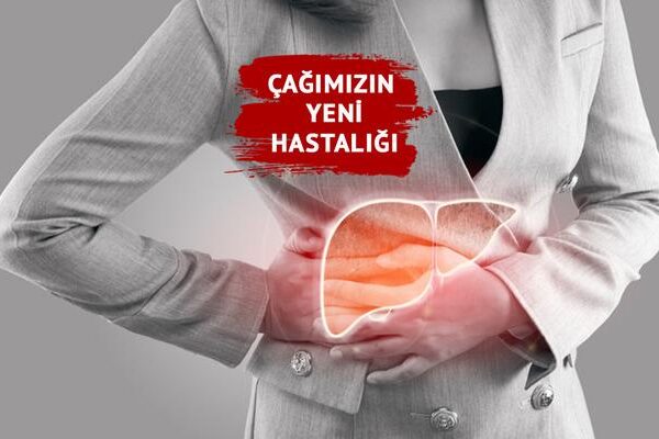 Yeni Yaş Hastalığı: Karaciğer Yağ! Son 30-40 yılda artıyor! Karaciğer yağına neden olur mu? Uzmanların uyarıları …