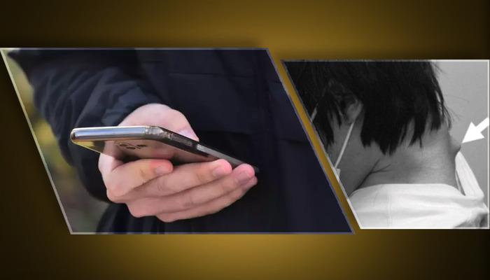 25 -Young Young’ın Boynu! Telefonun sürekli kullanımı ciddi boyun hasarına neden oldu: düşük kafa sendromu ile tıbbi literatüre girdi …