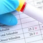 Bilirubin ne anlama geliyor? Bilirubin’in yüksekliği ve spontan kürtajı ne anlama geliyor ve kürtaj?