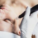 Dermapen nedir, ne yapar? Dermatpen tedavisi nasıl uygulanır?