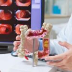 Kolonoskopi nedir? Kolonoskopi nasıl yapılır? Kolonoskopi ne zaman gereklidir?