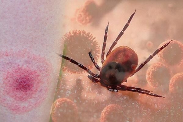 Keneler Tehlike: Lyme hastalığa neden olur: bu semptomlara dikkat! Uzmanlar uyarıyor: “Lyme hastalığı ölümcül olabilir”