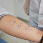 Hangi doktor alerjik teste gidebilir? Alerji testi hangi bölüme benziyor?