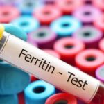 Ferritin eksikliği nedir? Ferritin eksikliğini nasıl geçersiniz?