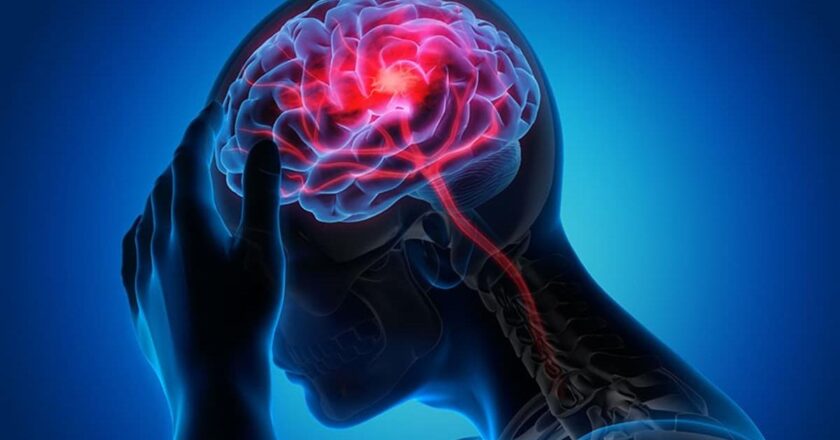 İnme Nöroloğundan Uyarı: ‘Erken Müdahale İnmeyi Önler’